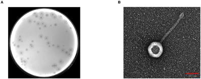 Genomic characterization of a new phage BUCT541 against Klebsiella pneumoniae K1-ST23 and efficacy assessment in mouse and Galleria mellonella larvae